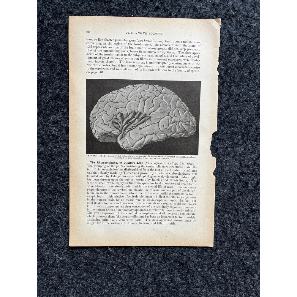 Original 1913 Anatomy Pages of Human Body, Anatomy Physiology Textbook Gifts, T